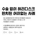 황당하게 허리디스크 완치된 사례 이미지