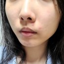 뽀송몰