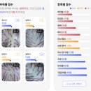 비채헤어 - 수성구 지범로 208 | 가산 두피관리 "비채두피탈모센터" / 가산 두피케어...서울 두피케어, 서울 헤드스파, 문제성두피관리 후기