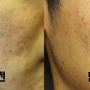 슈퍼워시 이미지