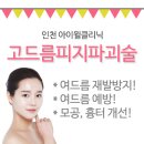 구월동 여드름 흉터 아이윌클리닉에서 말끔하게 제거하세요. 이미지