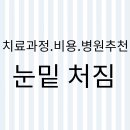 휴고성형외과의원 | 눈밑 처짐 치료 과정.비용.병원 추천