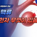 뇌동맥류, 정말 시한폭탄일까 이미지