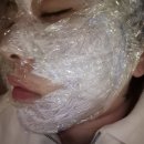 피오티 | 광명 소하동피부과추천 스컬피오 리프팅레이저 내돈내산후기