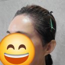 은혜헤어라인 이미지