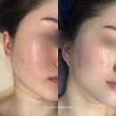 GS25진주대명점 | 진주윤곽관리 진주피부관리 잘하는 곳, 차크란에스테틱 후기
