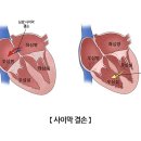 막