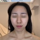 새롭게 | 다산피부관리 웰니스 리셋 시그니처 케어 <나를새롭게만들다> 후기