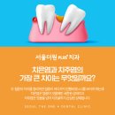 서울더원플러스치과의원 | 사당잇몸치과 치은염과 치주염, 어떤 차이가 있을까요?