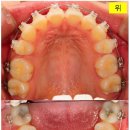 석치과기공소 이미지