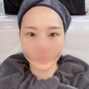 대구남구피부관리 대명동 루즈에스테틱 물톡스 필링후기