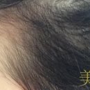 개미헤어아트 이미지