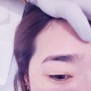 장항동왁싱 정발산왁싱 시아뷰티 에서 헤어라인 왁싱한 후기