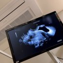 에프엠2차 이미지