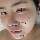 루비비네 | 안산 고잔동 맞춤케어전문 루에스테틱에서 홍조 문제성트러블케어 피부관리 받고왔어요.