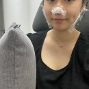 행복하면 | [대구] 대구 코조각주사 슬렌코 코지방분해주사 후기 -1 (feat.콧볼보톡스)