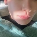 스킨패턴 | 강남 압구정역 성형외과 스킨바이브 후기