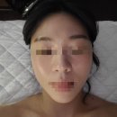 신비체테라피
