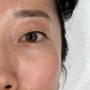 상남2층약국 | 창원 상남동 피부관리 에스테틱 예민 홍조 고민, 르네아 바이더랩 창원상남점 맞춤관리 후기