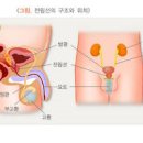 전립선 비대증 및 원인, 약물 수술 (야간빈뇨, 절박뇨, 잔뇨감, 통증) 이미지