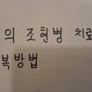 빙의 조현병 치료와 극복방법 이미지