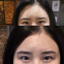 오일캠프 | 서산 미용실 바운스헤어캠프 로데오점 앞머리 다운펌 헤어라인 변형 스타일 변화 후기