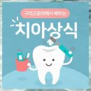 구의고운미치과의원 | 자양동치과 사례 및 후기