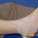 산행전,후 필요한 발목 무릎인대 예방 및 인대 손상시 테핑치료법 이미지