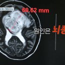 서울아산신경외과 티스토리