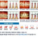 찬스플란트치과의원