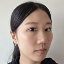 리메디컬 | 수원시청역 리프팅 잘하는곳 인계동 메디컬오 한의원에서 실리프팅 하고왔어요 ^^