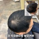 두피컬러링 40대 남성 자연스런 정수리 탈모커버 변화 후기