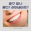 에이스외형복원 | 광주 앞니 레진? 라미네이트? 어떤 방법이 좋을까