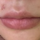 홍대고운세상피부과의원 이미지