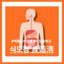 도청약국 | 역류성식도염 약국약, 먹어도 계속 재발했던 30대 남성 이야기