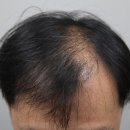 모나라피부과의원 이미지