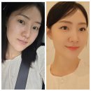 조이 187 더링크 이미지
