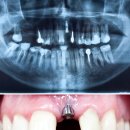 안산이미지치과의원 | 안산에서 치료 후기가 좋은 안산치과 추천 BEST 5 비교
