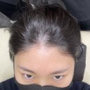 하프톤 스칼프 이미지