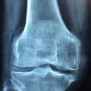 튼튼꾸러기한의원 이미지