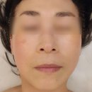 에스테틱베이비페이스 이미지
