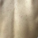 메디스코 | [내돈내산] 메디스코 시너지필 셀프 등 해초필링 솔직후기 (효과, 통증, 주의사항 총정리)