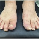 뷰티 라이프 샵 | 시흥 목감 은계 무좀발톱 전문샵 방문 후기 뷰티업라이프 뷰티제작소 시흥장현점