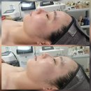 서이 | 삼척 피부관리 추천, 실력으로 인정받은 1인 에스테틱 ‘서이테라피’ 관리 후기