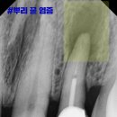 뿌리심는치과 이미지