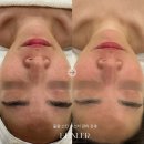비앙리에 이미지