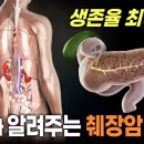 명의가 알려주는 췌장암 신호 이미지