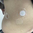 라이프웨이브 패치 2주간 암 환자 활용 후기 - X39 , 아이스 웨이브 , 글루타치온