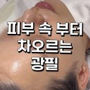 신애에스테틱 | 아프지 않고 피부가 좋아지는 필 서면 피부관리 리라신 ‘애씨큘’ 필링 관리 후기