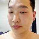 김포 구래동 피부관리 잘하는 곳 피부애진심에서 등관리와 스페셜 스킨케어 후기